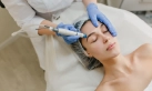Professional applying laser treatment for skin rejuvenation
