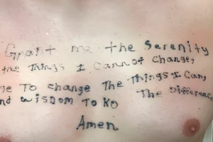 Before image showing full chest tattoo prior to first laser tattoo removal session at Lotus Laser Aesthetics, MN