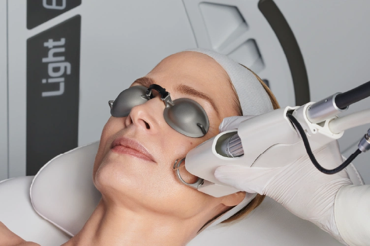 Woman receiving laser acne treatment with EVO Light at Lotus Laser Aesthetics.