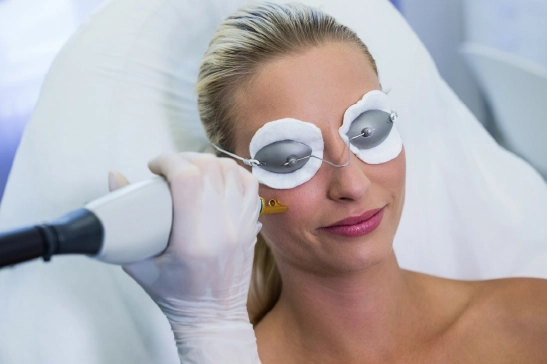 Laser treatment for acne scars at Lotus Laser Aesthetics, with a focus on stimulating collagen for smooth, radiant skin.