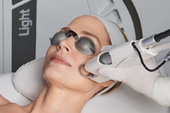 Woman receiving EVO Light treatment for acne and skin rejuvenation at Lotus Laser Aesthetics