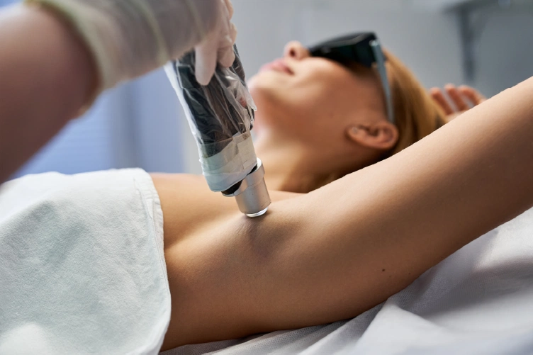 Laser hair removal treatment on a woman's underarm using advanced technology at Lotus Laser Aesthetics