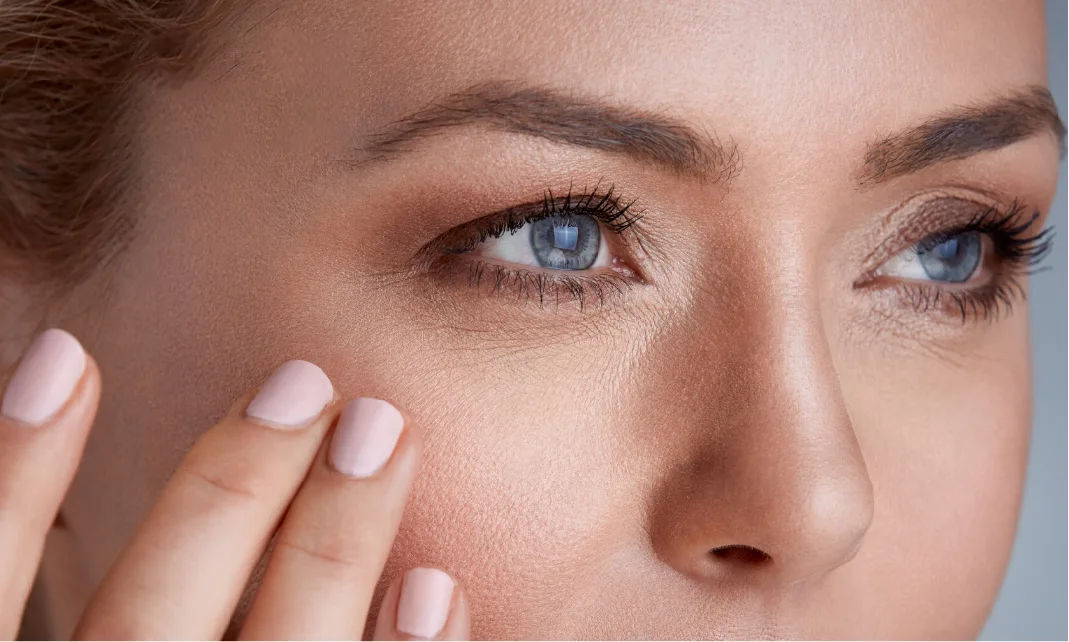 Laser Skin Treatment for Acne Scars & Hyperpigmentation