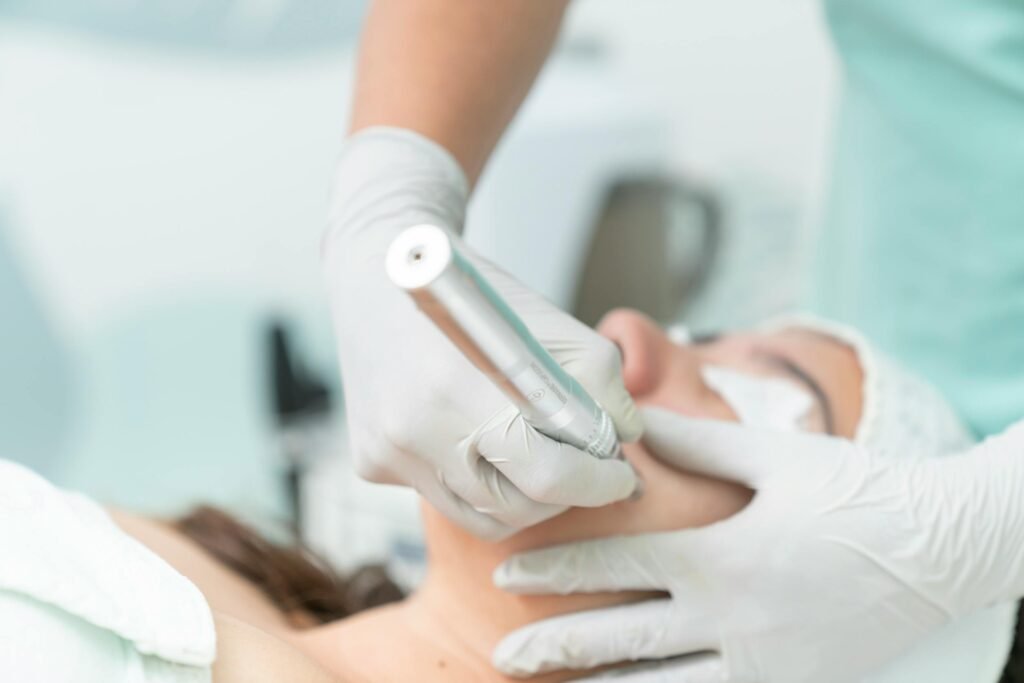 microneedling