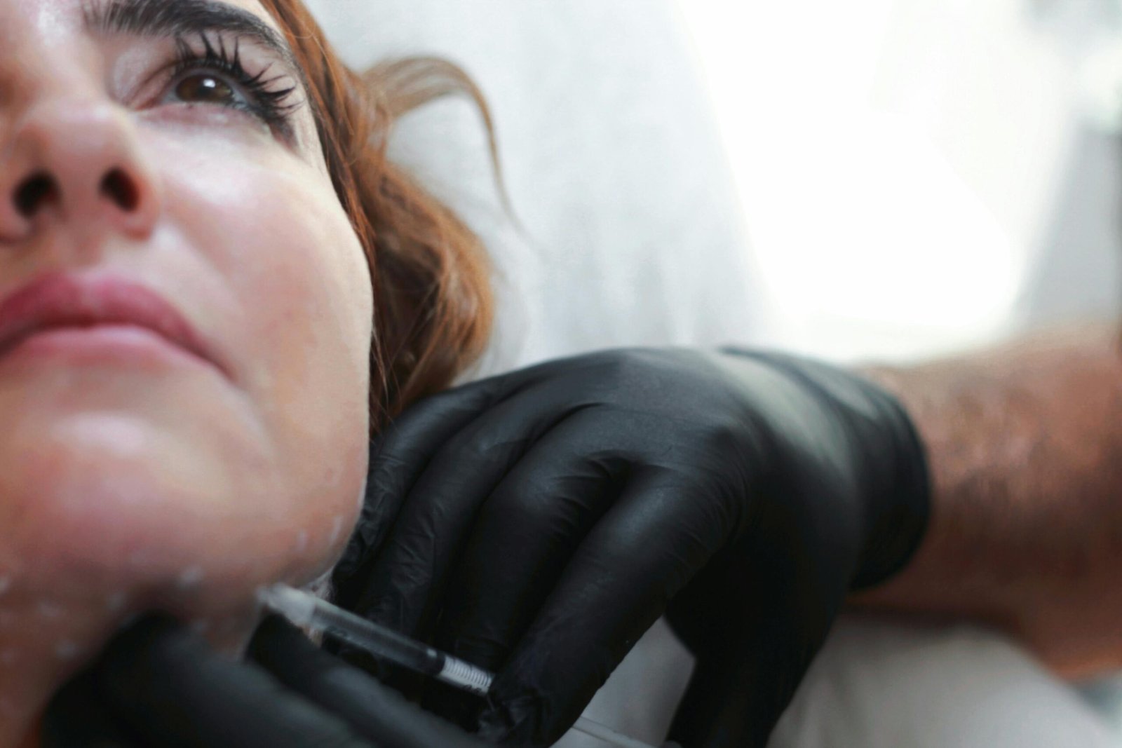 Dermal Filller